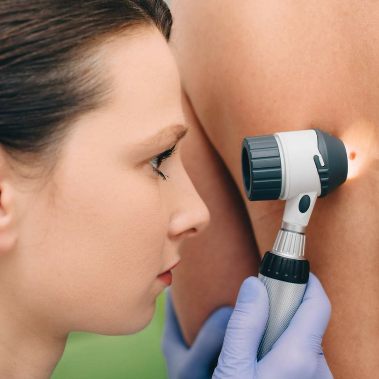 Диагностика кожи в медицинской косметологии. Метод дерматоскопии